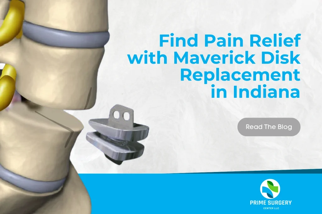 Find Pain Relief with Maverick Disk Replacement in Indiana