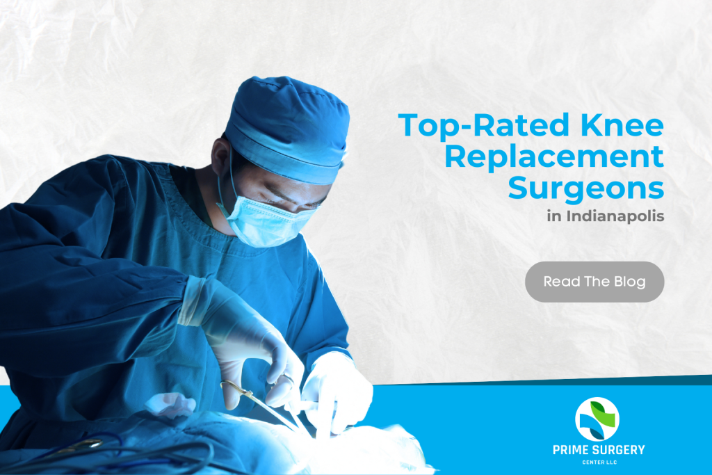 top-rated-knee-replacement-surgeons-in-indianapolis